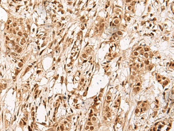 ZBTB43 Polyclonal Antibody (E-AB-52645)