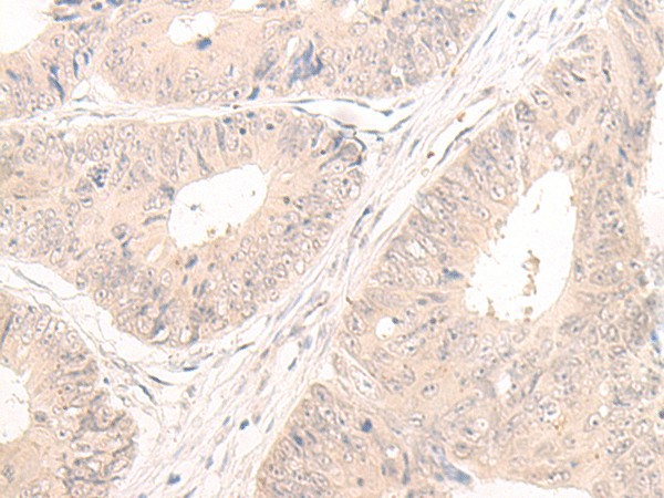 LCMT2 Polyclonal Antibody (E-AB-52661)