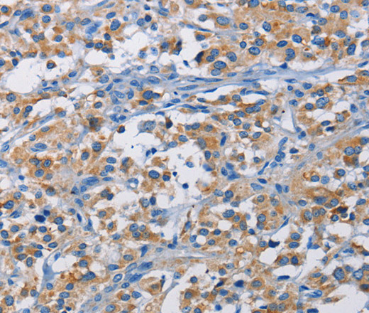 RICTOR Polyclonal Antibody (E-AB-10904)