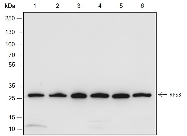 Recombinant RPS3 Monoclonal Antibody (AN301957L)