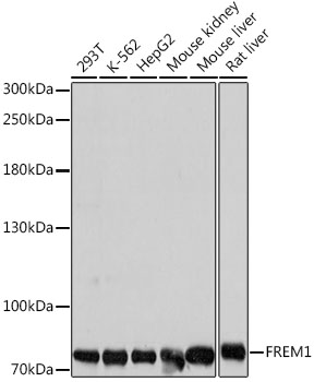 FREM1 Polyclonal Antibody (E-AB-66871)
