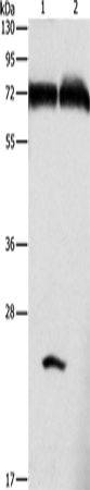 GDPD5 Polyclonal Antibody (E-AB-14625)