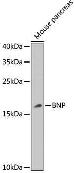 BNP Polyclonal Antibody (E-AB-67421)