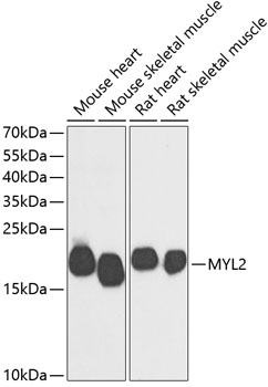 MYL2 Polyclonal Antibody (E-AB-64950)