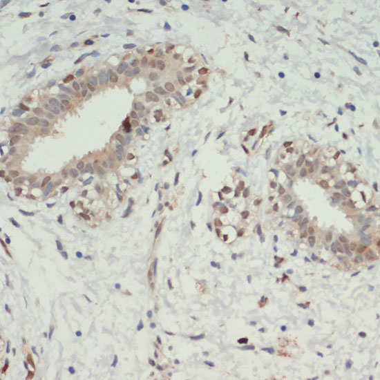 KDM6A Polyclonal Antibody (E-AB-63874)