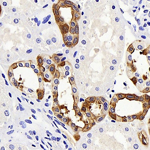 COL18A1 Polyclonal Antibody (E-AB-70197)