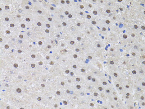 HUS1 Polyclonal Antibody (E-AB-64873)