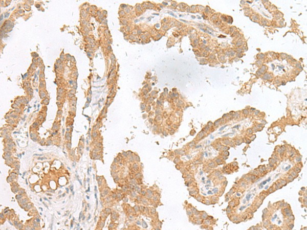 CXCL6 Polyclonal Antibody (E-AB-19904)