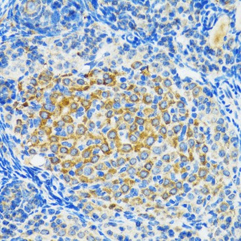SIRT2 Polyclonal Antibody (E-AB-60061)
