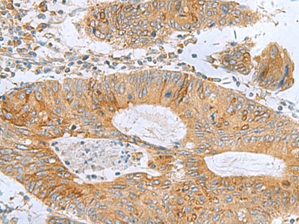 TXNDC12 Polyclonal Antibody (E-AB-53059)