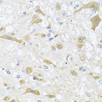 APOL1 Polyclonal Antibody (E-AB-62973)