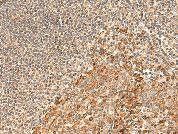 GALNT12 Polyclonal Antibody (E-AB-18959)