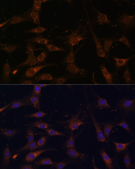 RAB21 Polyclonal Antibody (E-AB-63624)