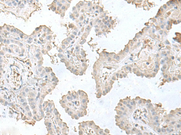 LSM10 Polyclonal Antibody (E-AB-18768)