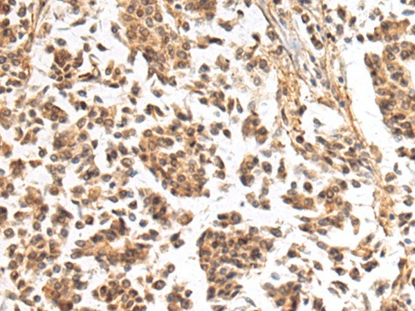 NHLRC2 Polyclonal Antibody (E-AB-53175)