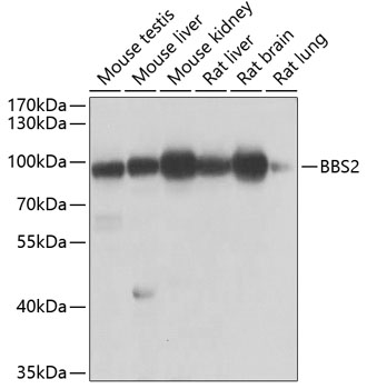 BBS2 Polyclonal Antibody (E-AB-62011)