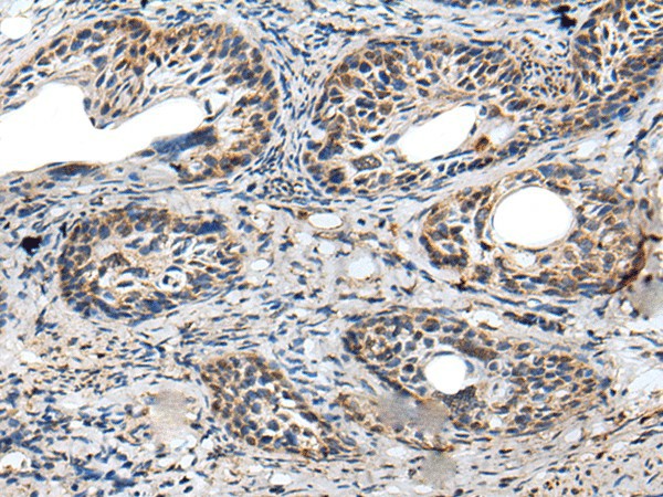 PRNP Polyclonal Antibody (E-AB-18439)
