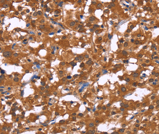 HLTF Polyclonal Antibody (E-AB-13294)