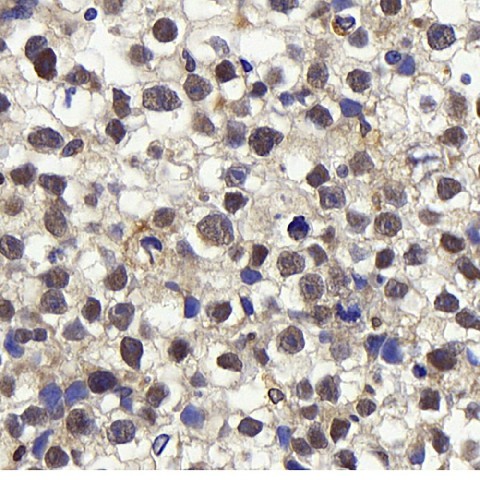 Cyclin E1 Polyclonal Antibody (E-AB-70166)