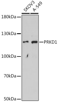 PRKD1 Polyclonal Antibody (E-AB-66714)