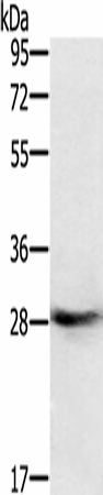 RAB8B Polyclonal Antibody (E-AB-16743)