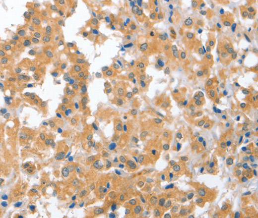 CDR2 Polyclonal Antibody (E-AB-11068)