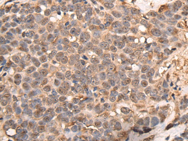 ATRIP Polyclonal Antibody (E-AB-18528)