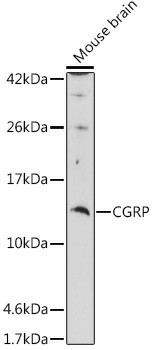 CGRP Polyclonal Antibody (E-AB-93381)