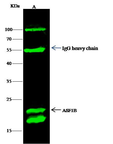 Recombinant ASF1B Monoclonal Antibody (AN300452P)