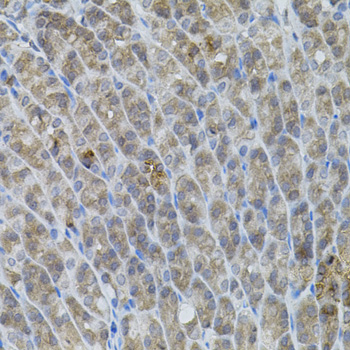 UBE2A Polyclonal Antibody (E-AB-63864)