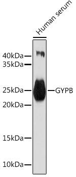 GYPB Polyclonal Antibody (E-AB-92797)