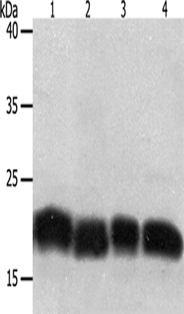 PDCD6 Polyclonal Antibody (E-AB-14287)