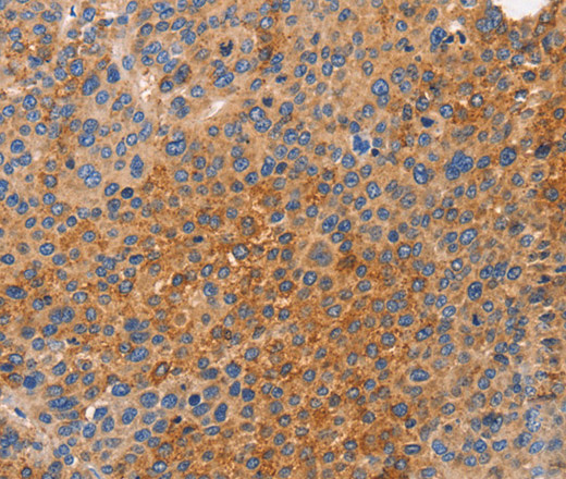 NOD1 Polyclonal Antibody (E-AB-13110)