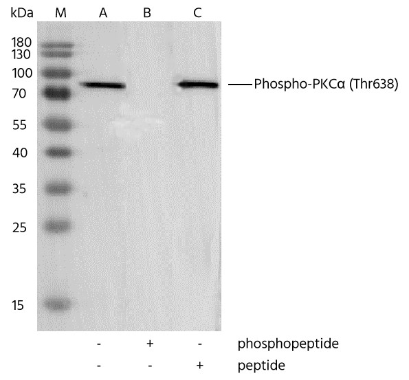 Recombinant Phospho-PKCα (Thr638) Monoclonal Antibody (AN300149L)