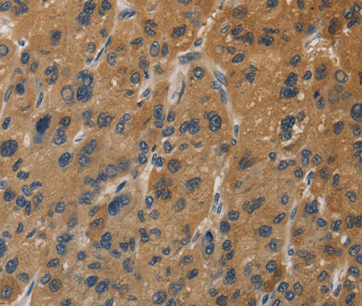 DUSP23 Polyclonal Antibody (E-AB-14964)