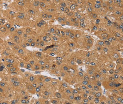KCNJ15 Polyclonal Antibody (E-AB-13569)