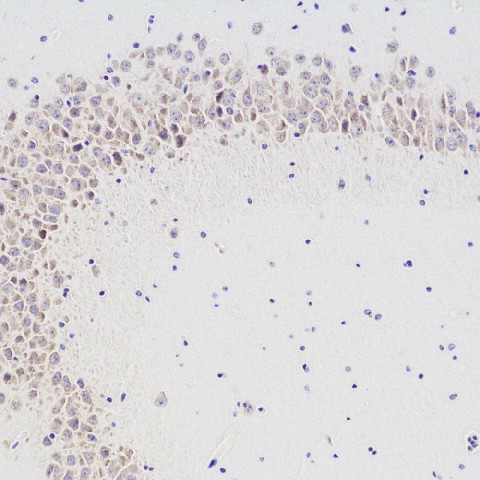 CHAT Polyclonal Antibody (E-AB-70028)