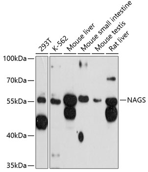 NAGS Polyclonal Antibody (E-AB-90339)