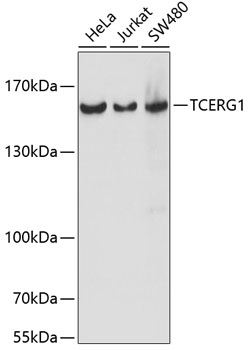 TCERG1 Polyclonal Antibody (E-AB-65130)