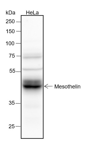 Recombinant Mesothelin Monoclonal Antibody (AN301600L)