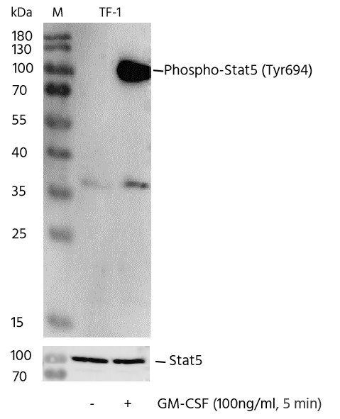 Recombinant Phospho-Stat5 (Tyr694) Monoclonal Antibody (AN300379L)