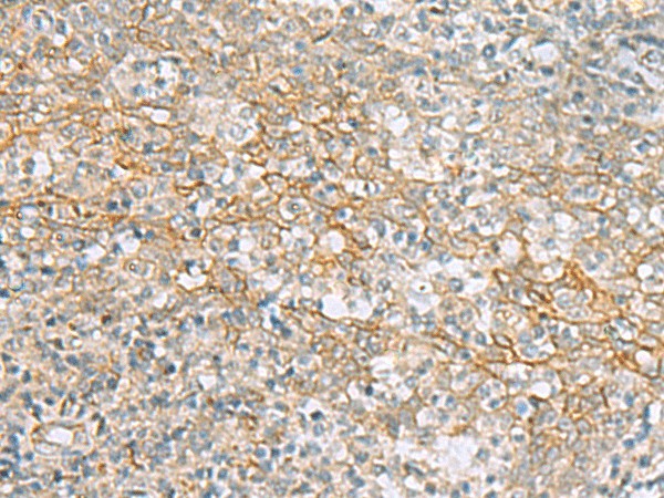 KCNH7 Polyclonal Antibody (E-AB-53444)