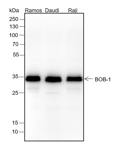 Recombinant BOB-1 Monoclonal Antibody (AN301449L)