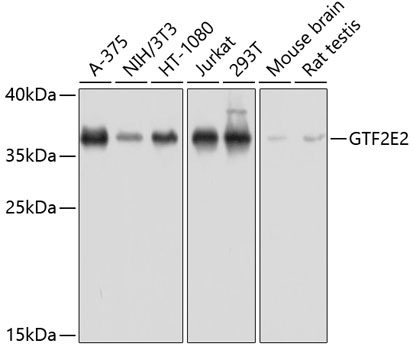 GTF2E2 Polyclonal Antibody (E-AB-63899)
