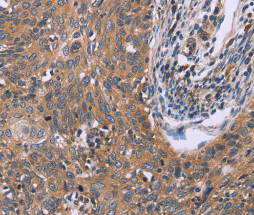 IL3RB Polyclonal Antibody (E-AB-13273)