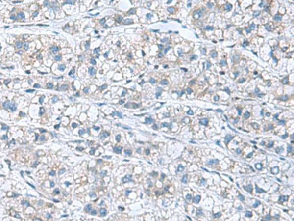 GDF9 Polyclonal Antibody (E-AB-52152)
