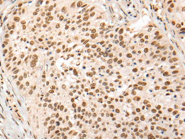 HOXA7 Polyclonal Antibody (E-AB-53296)