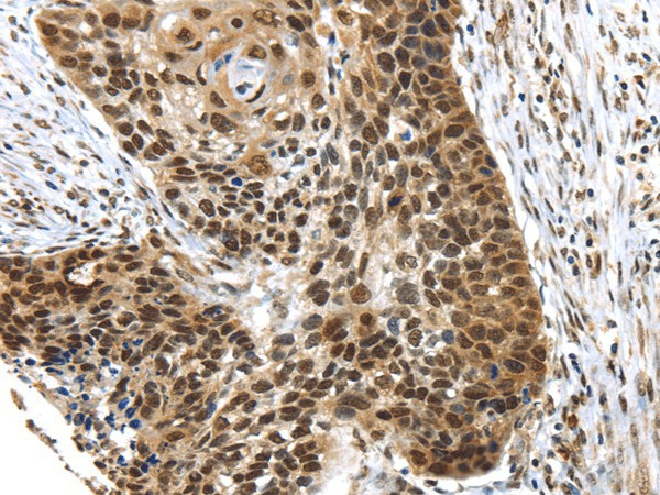 TEX37 Polyclonal Antibody (E-AB-17483)