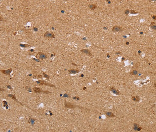 NDRG3 Polyclonal Antibody (E-AB-15995)