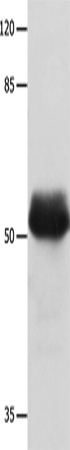 MUTYH Polyclonal Antibody (E-AB-14232)